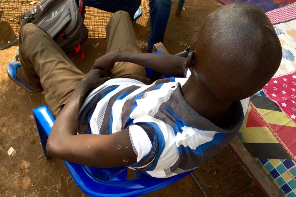 Мужчина-нуэр, по которому правительственные солдаты стреляли 7 раз на блокпосту у университета Джубы 8 июля 2016 г. 